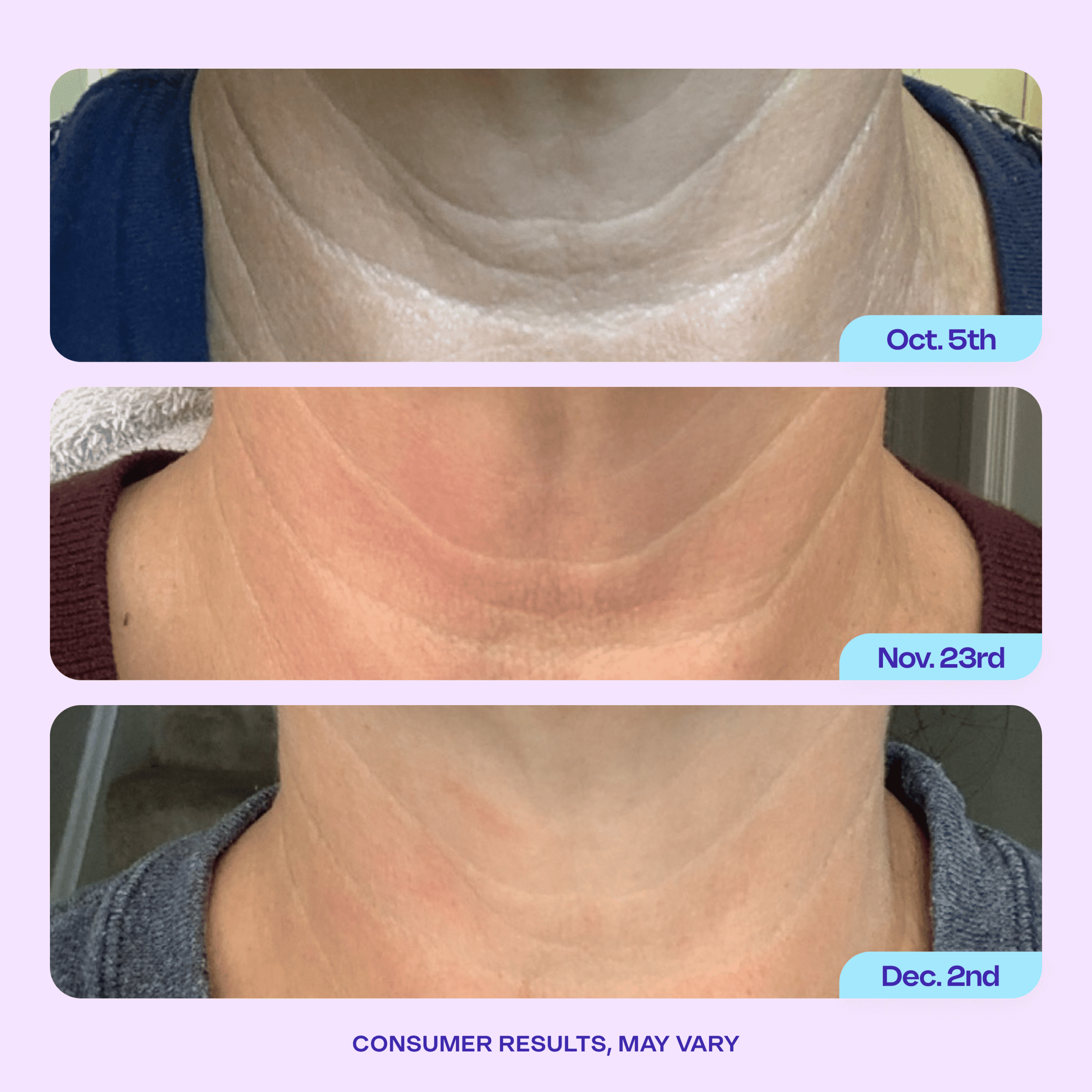 Tighten & Lift Neck Cream - Image 9