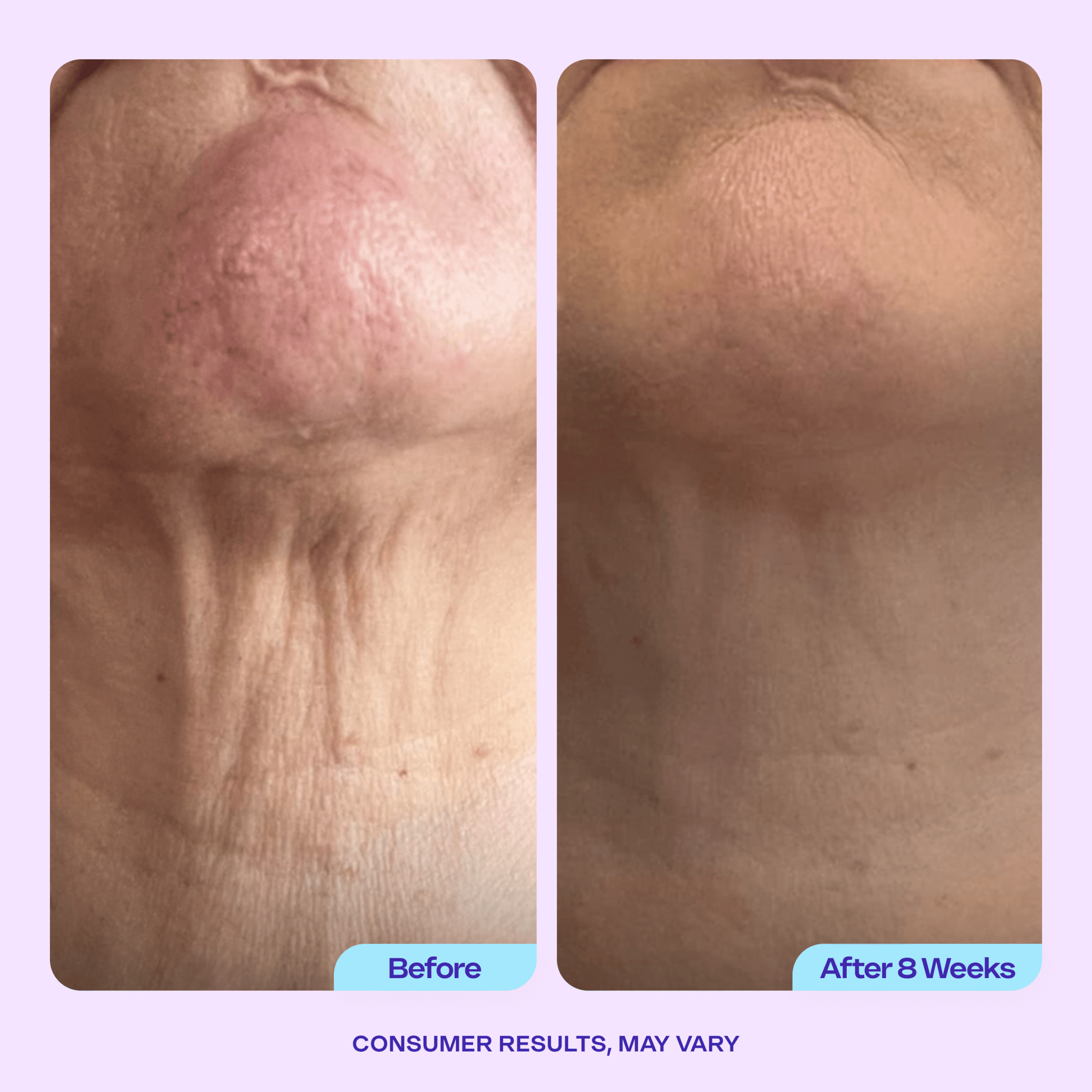 Tighten & Lift Neck Cream - Image 4